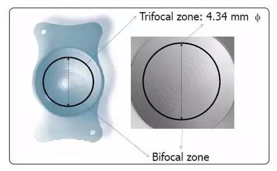 蘭州普瑞眼視光醫(yī)院成功實(shí)施德國蔡司三焦點(diǎn)人工晶體植入術(shù)