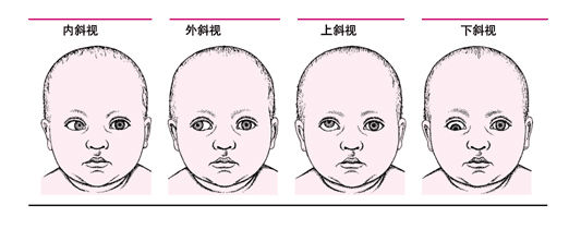 國(guó)內(nèi)知名兒童眼病專家岳以英教授空降蘭州