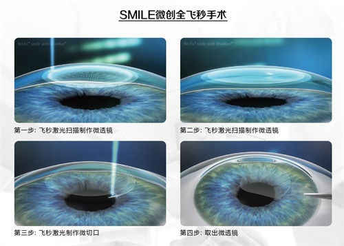 眼科謠言，你的“好心轉(zhuǎn)載”辦了多少壞事